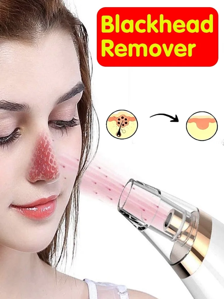 

Generation 2 Facial Blackhead Remover Vacuum Pore Adsorber Electric Pimple Blackhead Cleaner Usb Rechargeable Face Cleaning Tool