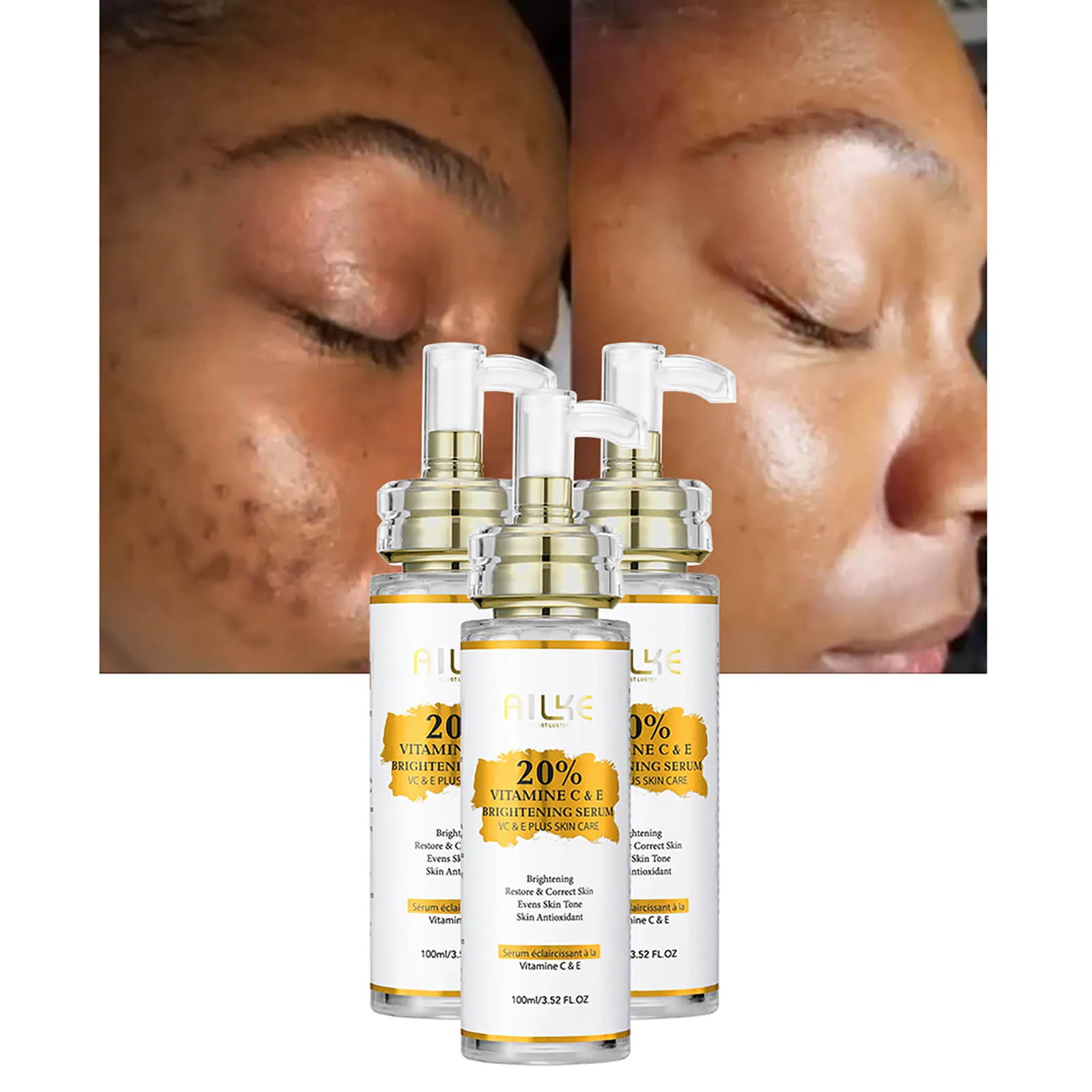 AILKE Vitamin C and E Brightening Concentrated Serum, Whitening, Moisturizing, Clean Skin, Reduce Dark Spots, 100ml/3.52 oz