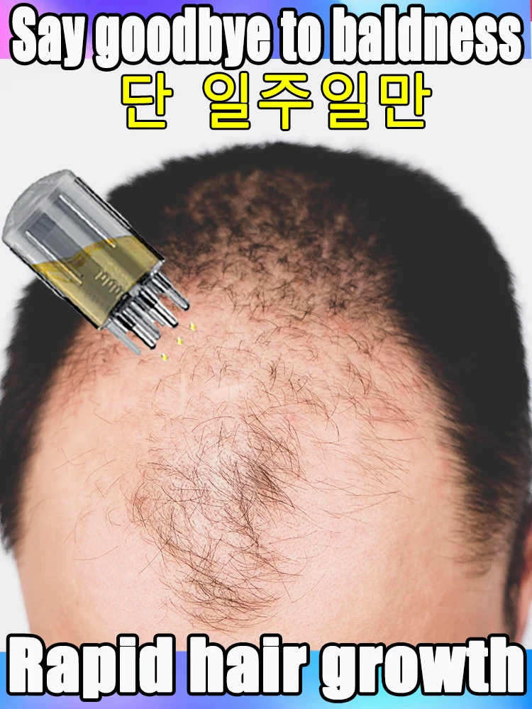 

have more and more hair, say goodbye to baldness