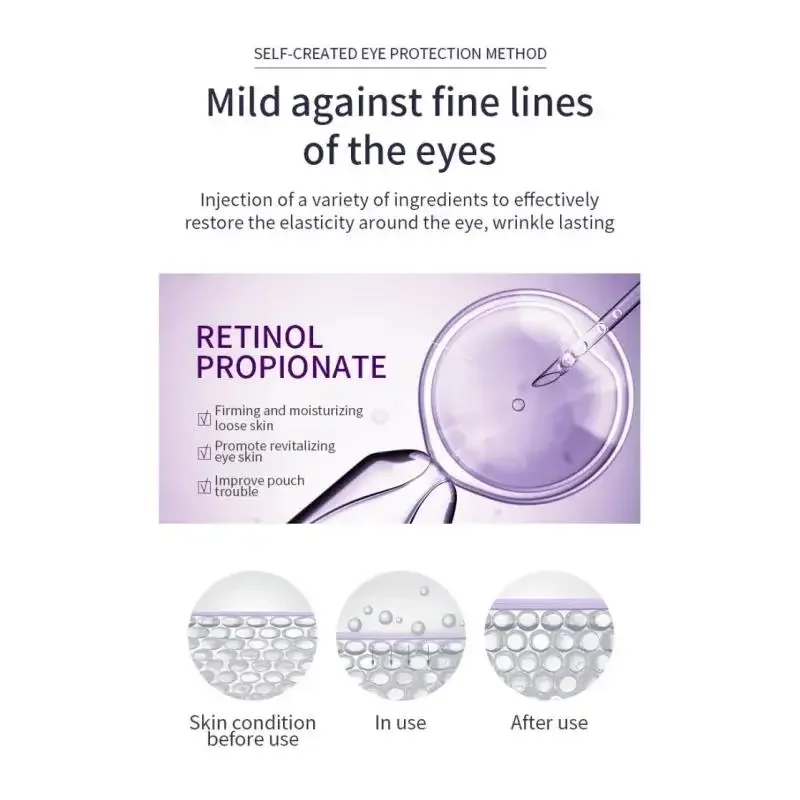 Tratamiento de círculos oscuros, crema para ojos, rodillo de ácido hialurónico, masajeador, bolsas hidratantes antiarrugas, reducción del envejecimiento, cuidado de la piel