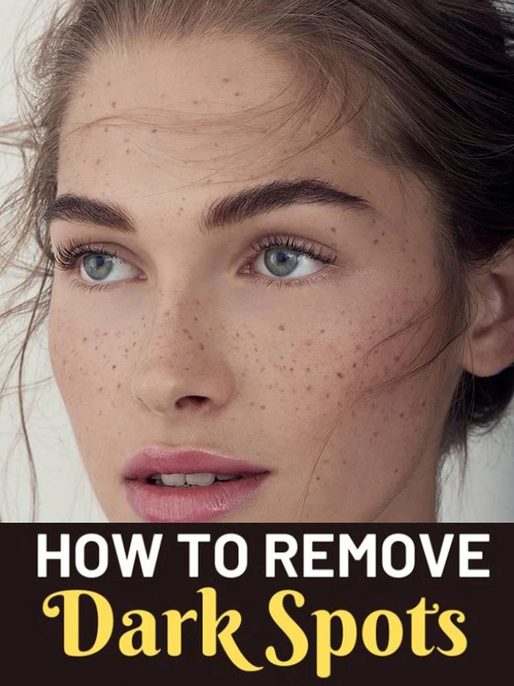 

Dark Spot Correcting Serum Remove Freckle Whitening Moisture Powerful Removal Sun Spots Melasma Age-related Dark Spots Brighten