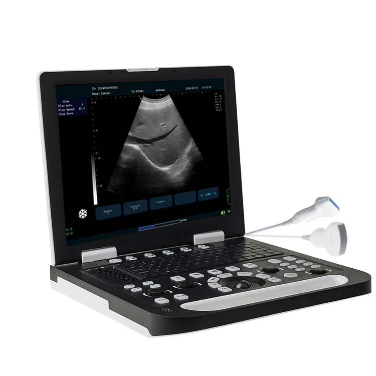 Veterinary Equipment Pet Full Digital Laptop Ultrasound Scanner Animal Sonar Scanner With Convex Array Probe