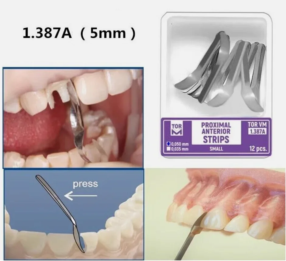 NIGF Tandheelkundige Matrixbanden Grote Kleine Twin Proximale Anterieure Strip Sectionele Voorgevormde Matrices Systemen Tandheelkunde Materialen