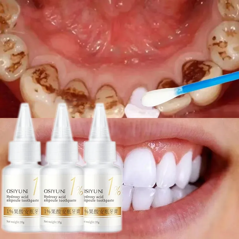 

Whitening Teeth Toothpaste Serum Dental Calculus Plaque Remover Preventing Periodontitis Dental Fresh Breath Health Care Product