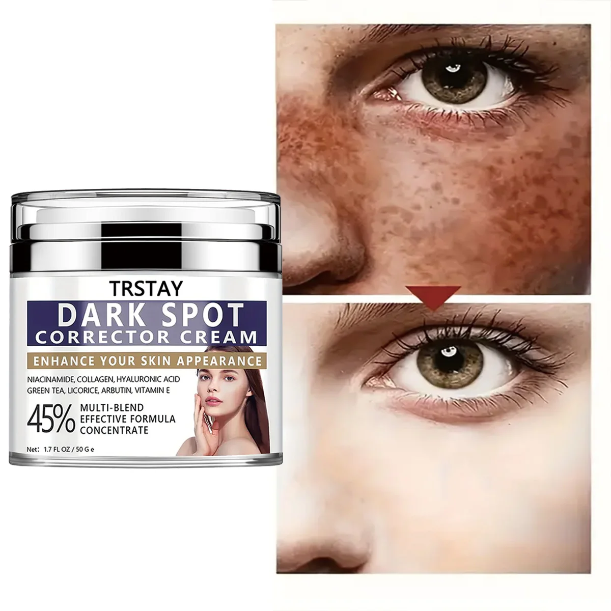 

TRSTAY Крем для коррекции темных пятен Ниацин Уход за кожей лица повышает внешний вид Беременность и беременность Мама и дети