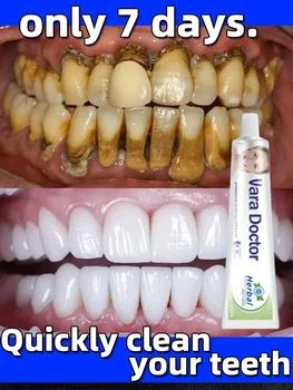 מסיר שיניים מחשבונים שיניים הלבנת הפה הסרת ריח ריח רע מהפה מניעת חניכיים