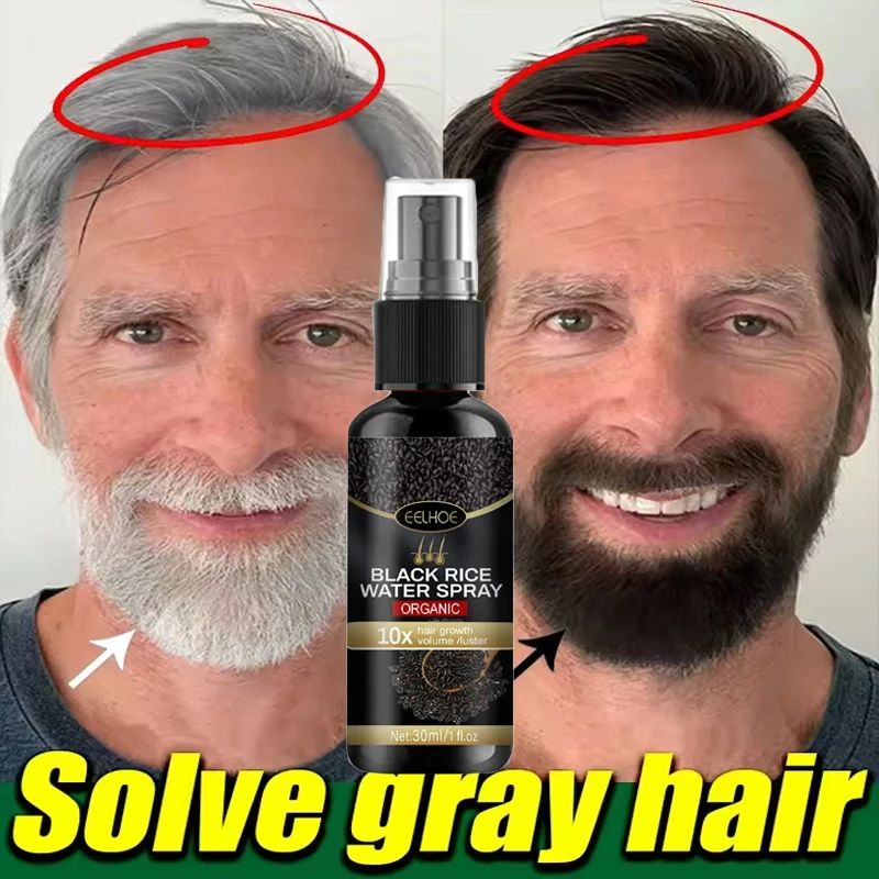 Grau-weißes Haar-Behandlungsserum, deckt weißes Haar ab, nach Schwarz ab, natürliche Farbe, Reparaturspray, Anti-Verlust-Haar, stellt gesunde Haarpflege wieder her