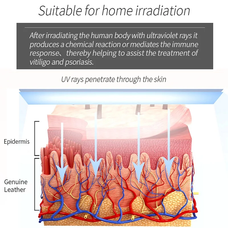 Home Use Psoriasis Equipment 311nm UV Lamps Phototherapy Medical Uvb Treatment Lamp For Vitiligo Therapy Device