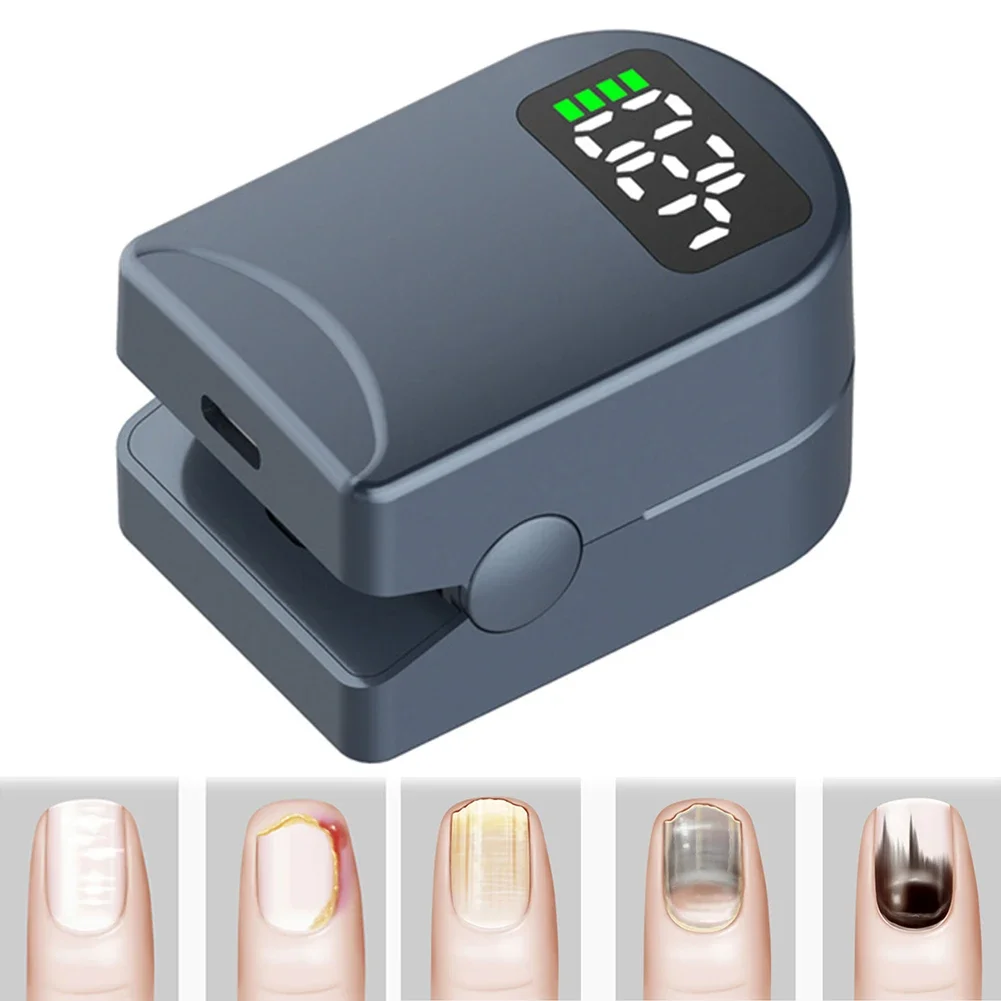 Dispositif de lumière fongique pour ongles, dissolvant fongique décoloré, lumière bleue 460nm + lumière infrarouge 905nm pour ongles épais et ongles
