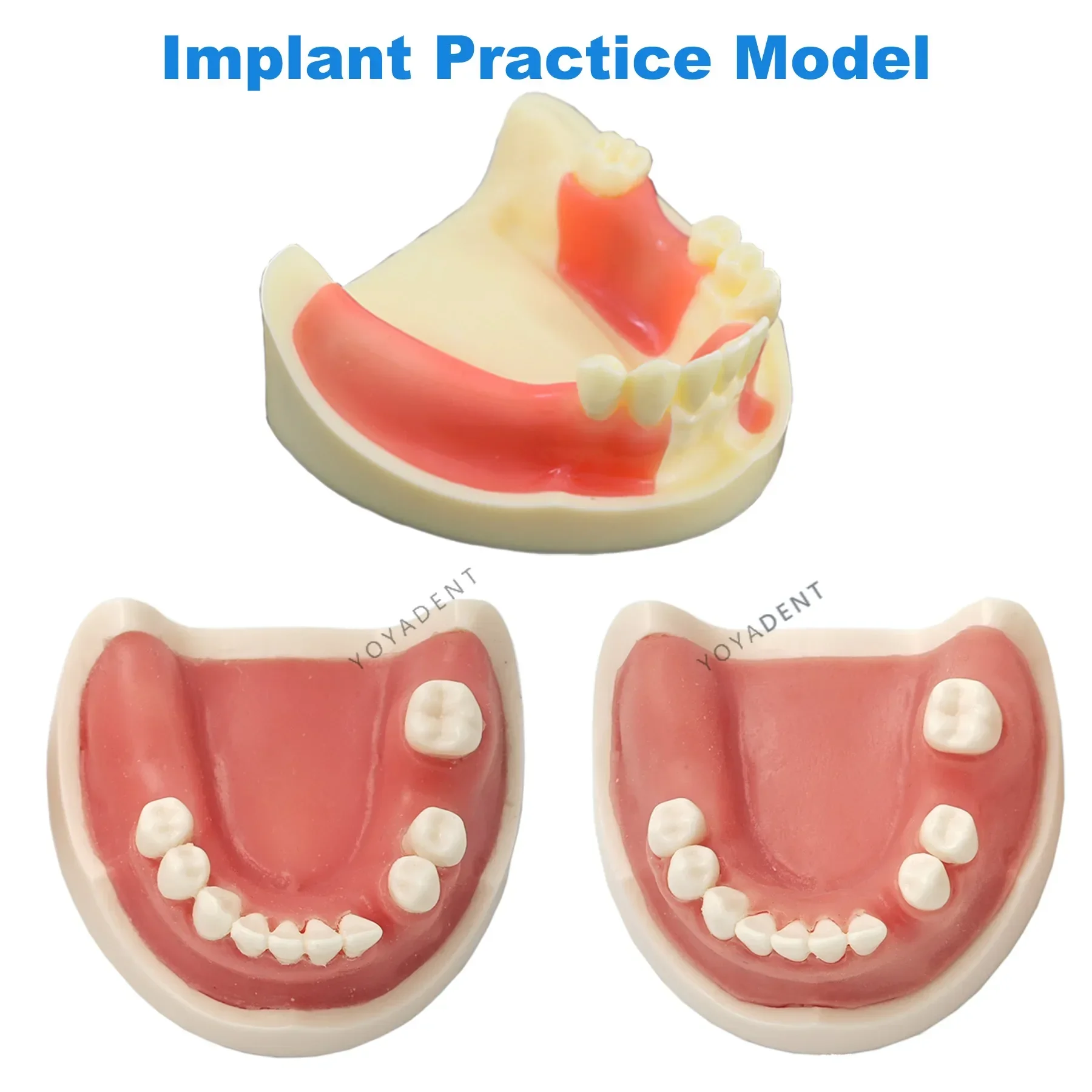 

Dental Implant Model Teeth Model For Dentistry Implant Training Gum Sutures Dentist Material Teaching Studying Product