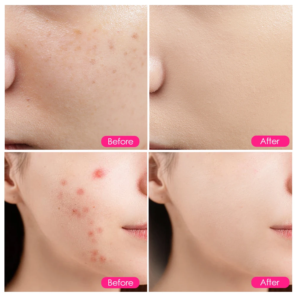 LED フォトン美容ライト青赤色光療法肌の若返りにきびそばかすしわ除去フェイシャルマスク美容機器 EU プラグ