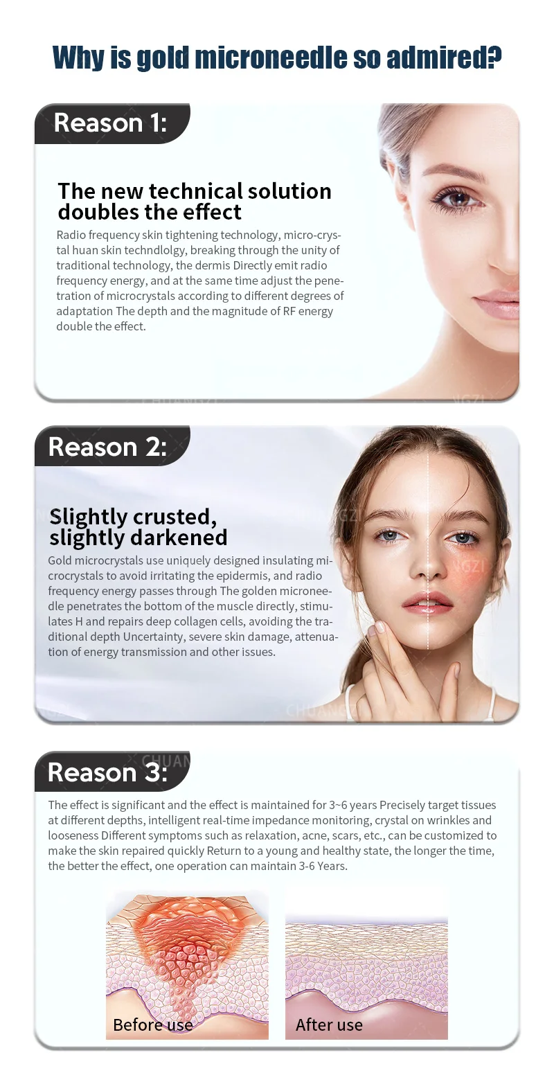 2 In 1 Gold RF Microneedle Machine, Fractional Radiofrequency Microneedling Device for Acne Scar Removal, Stretch Mark Reduction