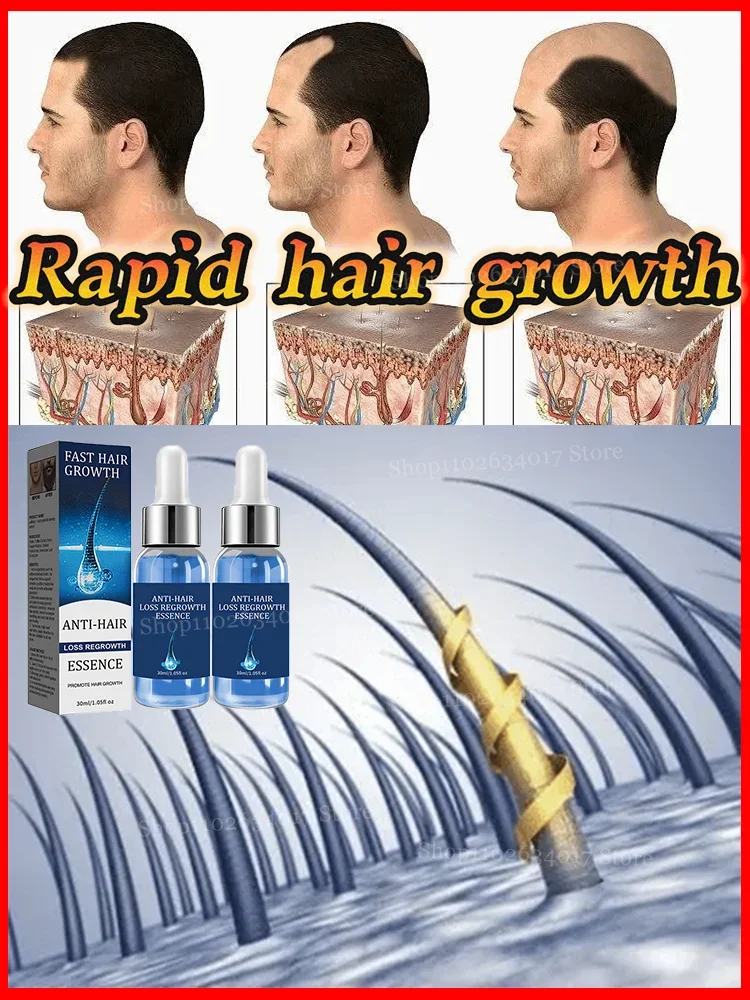 

Accelerate Hair Growth: Your New Hair Solution
