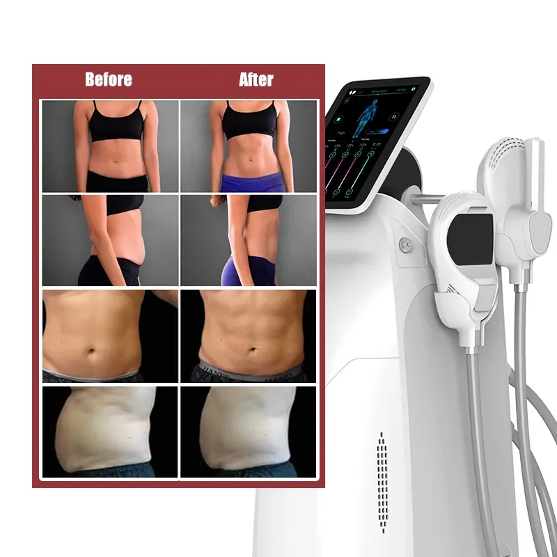 UMS Sculptor EMS RF Body Slimming Machine High Intensity Magnetic Muscle Stimulator Fat Burning Weight Loss Beauty Equipment