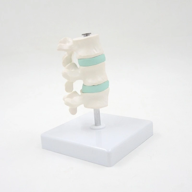 Osteoporosis disease model, spine and cervical dissection model, joint model