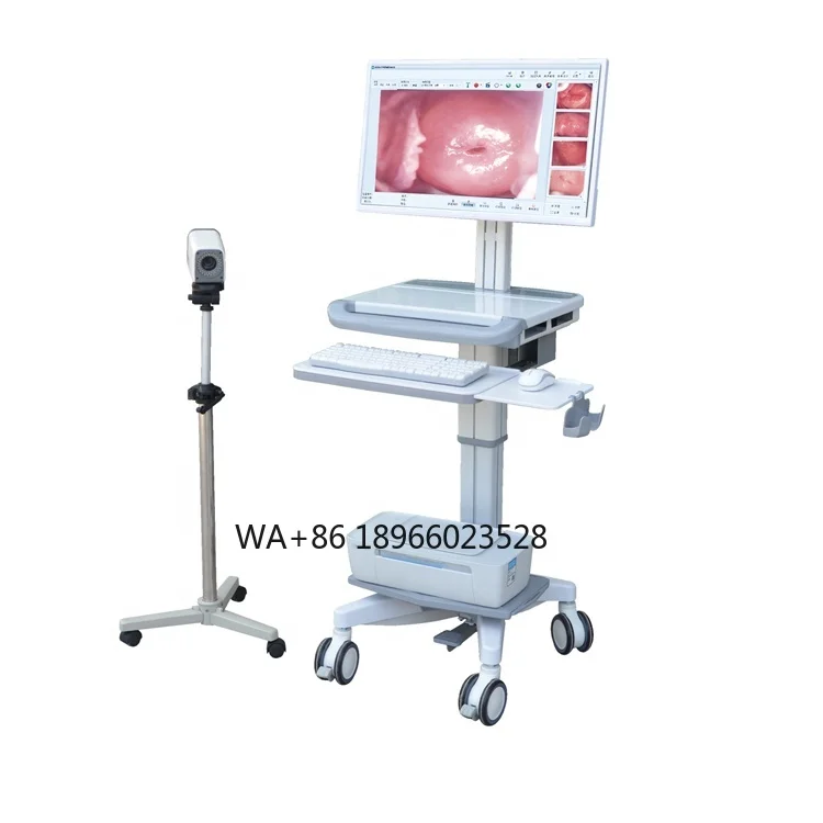

Full HD Caera Portable Video Colposcope Price Medical Device Vaginal Colpcopy Machine