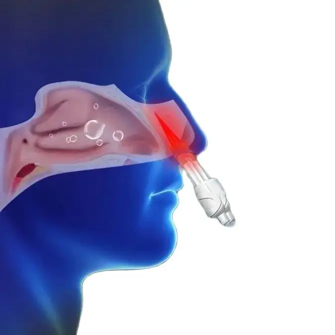 Rhinitis Sinusitis Laser Therapy Red Light Medical for Nose Irradiation Runny Nose Pharyngeal Nasal Physiotherapy Treat