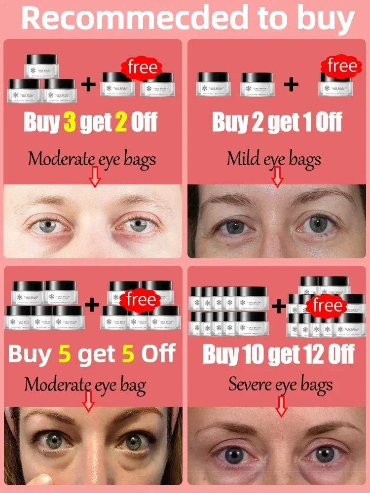 No Side Effects Eye Cream Remove Bag Dark Circles Puffiness Fine Lines Eyes