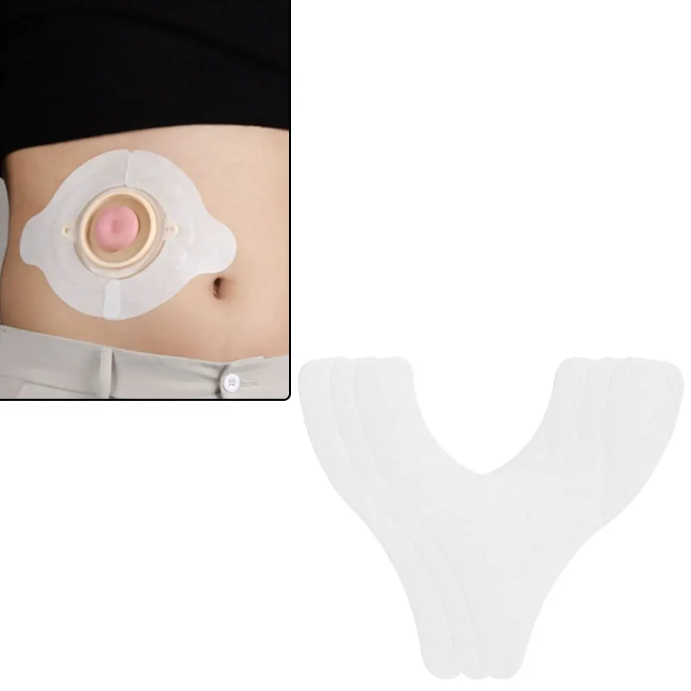 

Ostomy Barrier Strips Y Shape Adhesive Seal Extender Strip For Colostomy Bags Ileostomy Tape For Stoma Ostomy Bag Sticker