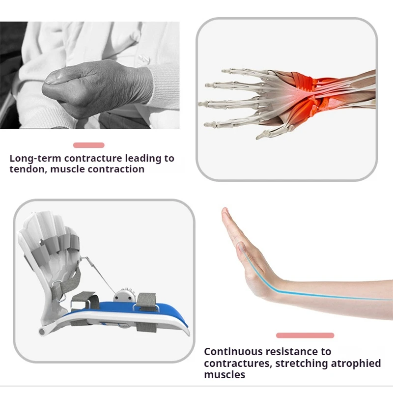 Função De Pulso De Treinamento De Reabilitação, Dedo De Mão, Curso De Hemiplegia, Correção De Curso De Braço