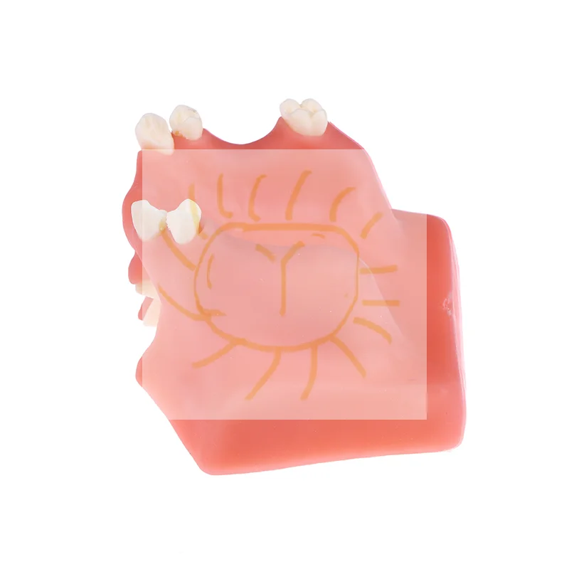 نموذج لشكل الأسنان الجيوب الأنفية، نموذج تعليمي لزراعة الأسنان لطلاب طبيب الأسنان، ممارسة دراسة النموذج الطبي عن طريق الفم #1