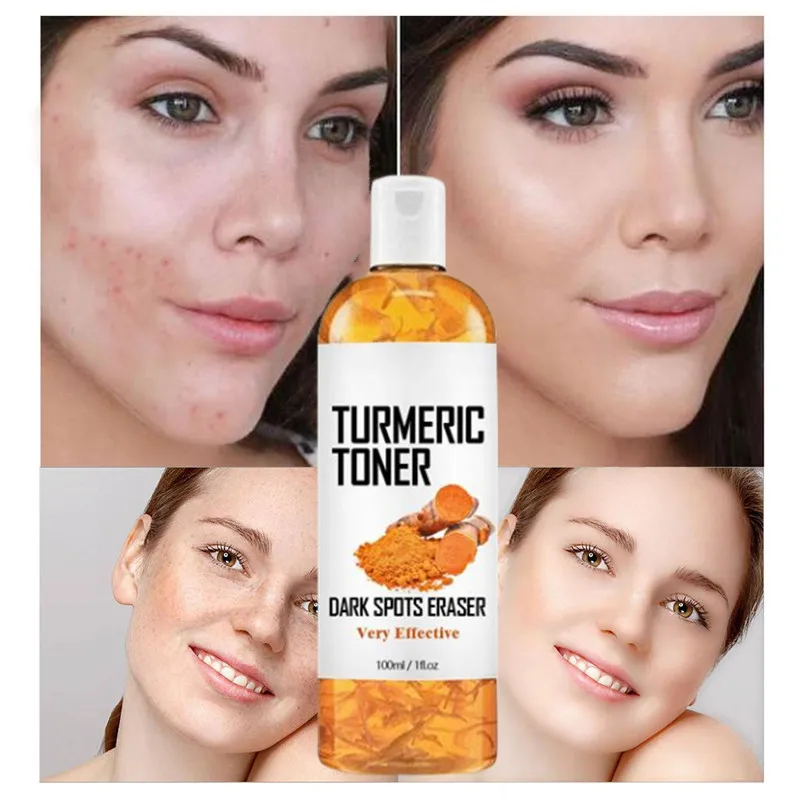 

100ml Turmeric Moisturizing Toner Acne Remover Reduce Dullness & Black Spots Firming Skin Toner Essence Toner for Skin Whitening