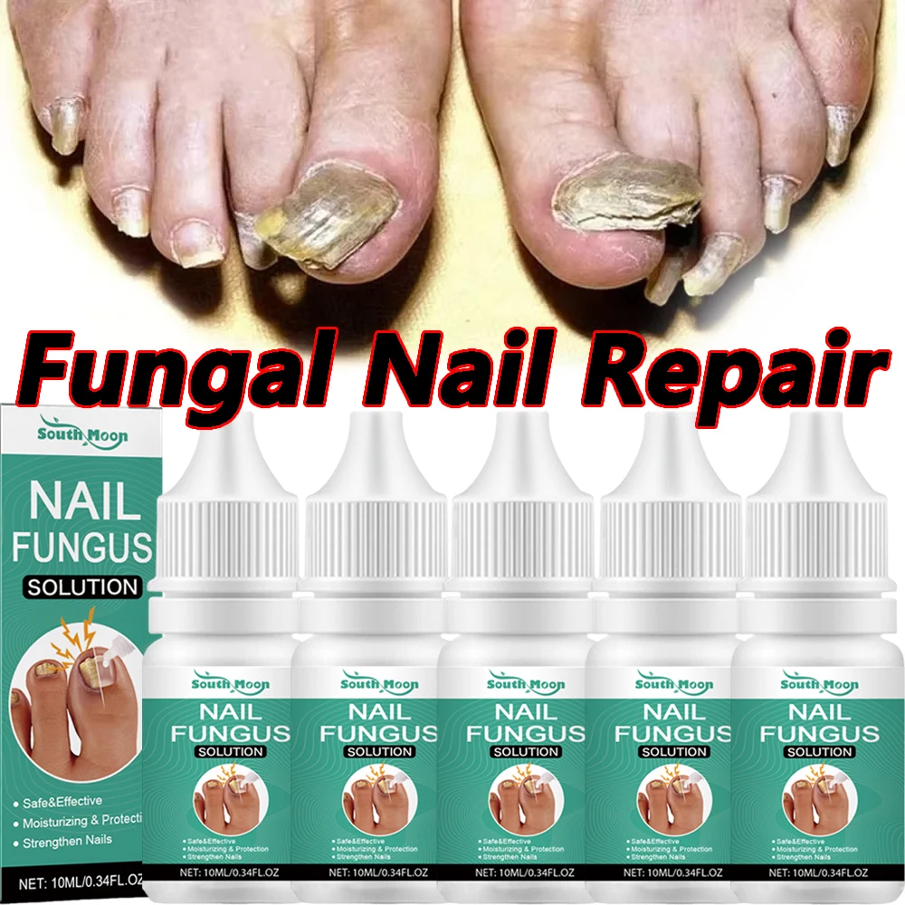 7 giorni Trattamento Fungine Delle Unghie Siero Piede Rimozione Fungo Delle Unghie Gel di Riparazione Anti Infezione Paronichia Onicomicosi Unghie Del Piede Cura
