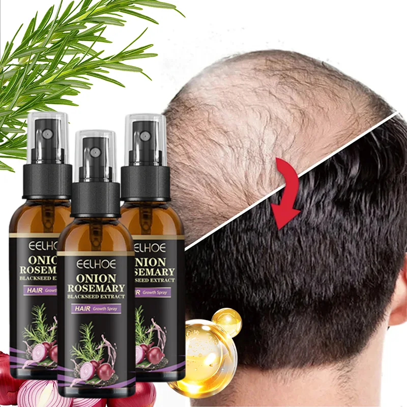 

3 Bottle 30ml Onion Rosemary Anti-Hair Loss Serum Rapid Hair Growth Conditioning Spray (for Men & Women)
