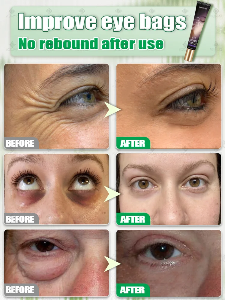 The best products of 2025,ᴵⁿˢᵗᵃⁿᵗˡʸ ʳᵉᵐᵒᵛᵉ ᵉʸᵉ ᵇᵃᵍˢ⸴ ʳᵉᵈᵘᶜᵉ ᶠⁱⁿᵉ ˡⁱⁿᵉˢ⸴ ᵗⁱᵍʰᵗᵉⁿ ˢᵏⁱⁿ⸴ ᶠⁱᵍʰᵗ ᵈᵃʳᵏ ᶜⁱʳᶜˡᵉˢ⸴ ᵃⁿᵈ ᵇʳⁱᵍʰᵗᵉⁿ ᵉʸᵉˢ