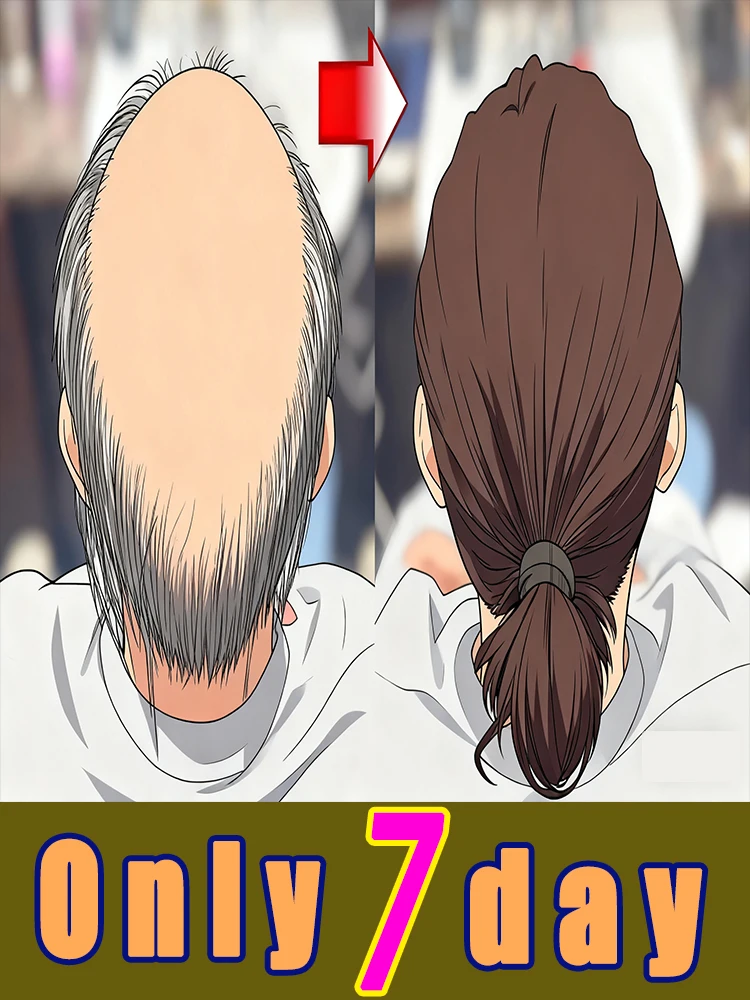 Rᴇᴘᴀɪʀ ᴛʜᴇ sᴄᴀʟᴘ ᴇɴᴠɪʀᴏɴᴍᴇɴᴛ ғʀᴏᴍ ᴛʜᴇ ʀᴏᴏᴛ, ᴄᴏɴᴛʀᴏʟ ᴏɪʟ ғᴏʀ ᴀ ʟᴏɴɢ ᴛɪᴍᴇ, ɪɴᴛᴇɴsɪᴠᴇʟʏ ɴᴏᴜʀɪsʜ ᴀɴᴅ ʜᴇʟᴘ ʜᴀɪʀ ʀᴏᴏᴛs ʀᴇɢᴇɴᴇʀᴀᴛᴇ