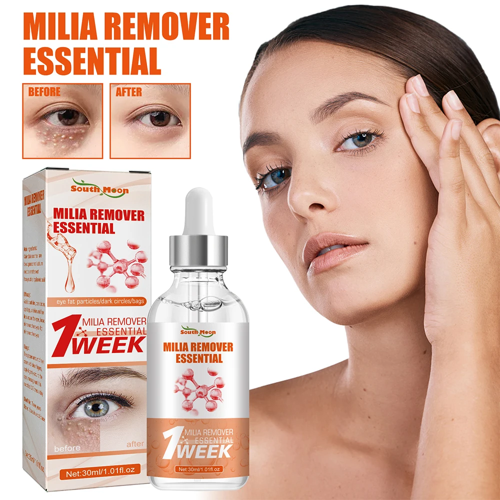 30ml Milia Remover Essential Eye Serum Effective Removes Fat Granules Eye Bags Anti-Particles Puffiness Improve Dark Cicle