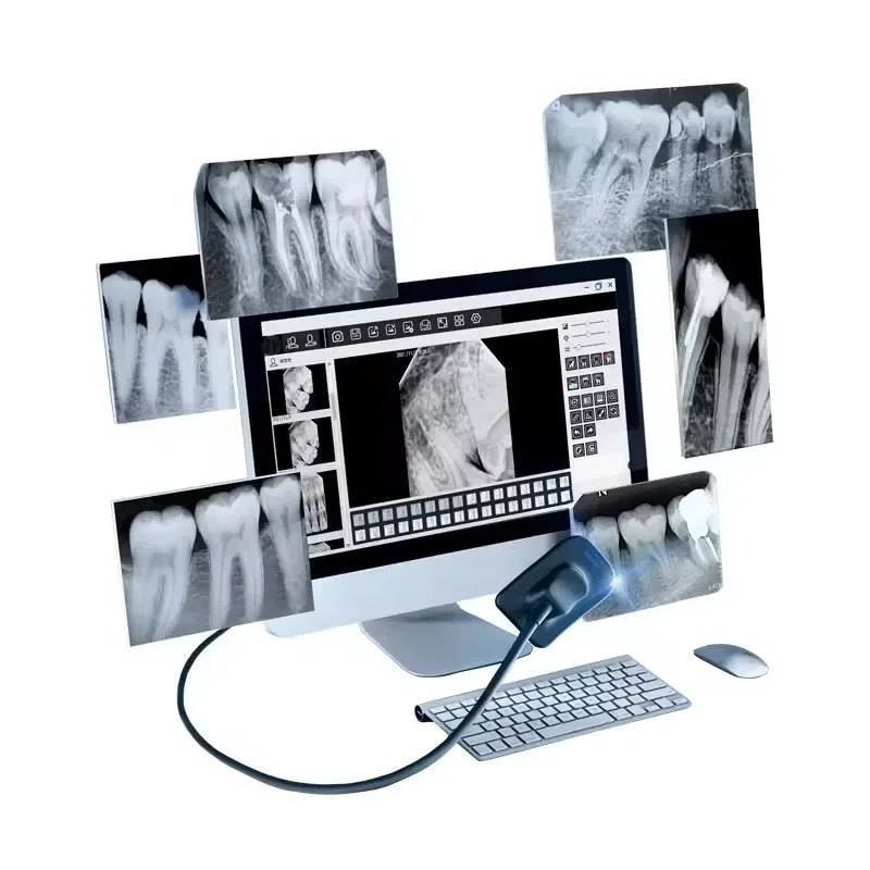 

dent Intraoral X-ray Sensor R1/ R2 Intraoral Digital Imaging System USB RVG Imaging Sensor for Dentist Clinic