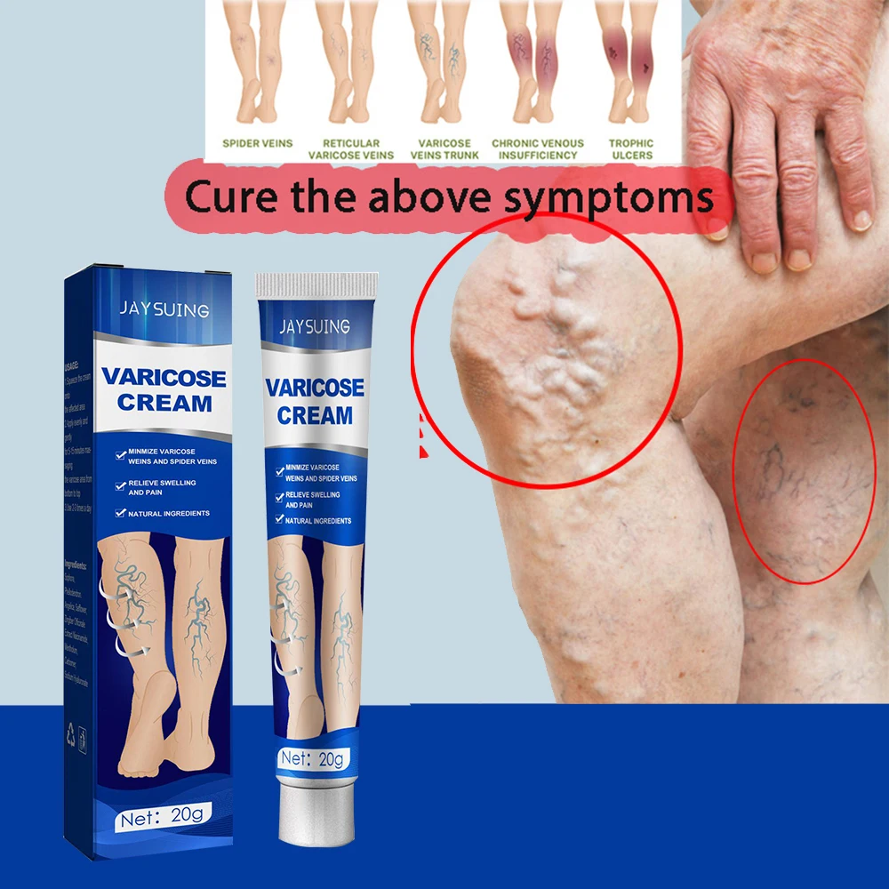 Varicose Vein Soothing Cream Gently Relieves Leg Discomfort Daily Massage Promotes Blood Circulation External Leg Care Cream