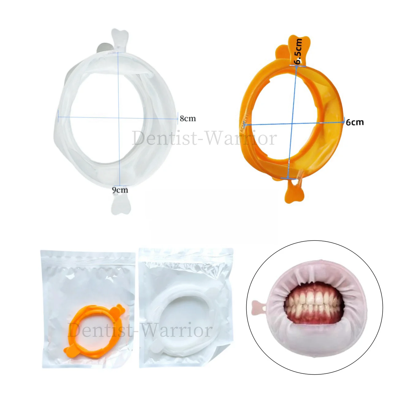 2~20Pieces Dental Mouth Opener Cheek Retractors Lips Protect Openers Large/Small