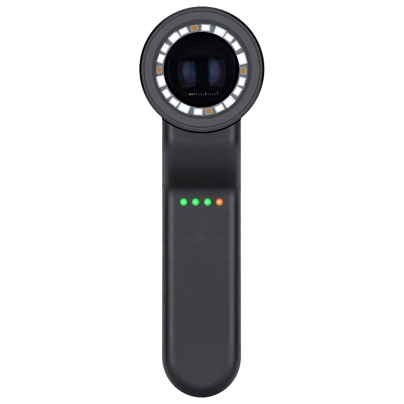 

Skin Analyzer, Handheld Optical Dermoscopy Melanoma Skin Diagnosis