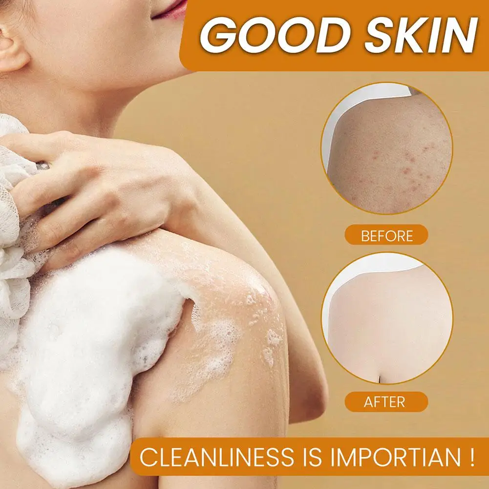 1/2/3pc limão orgânico cúrcuma sabão de ácido kójico para manchas escuras sabão de cúrcuma para lavagem facial iluminar corretor de manchas escuras cuidados com a pele