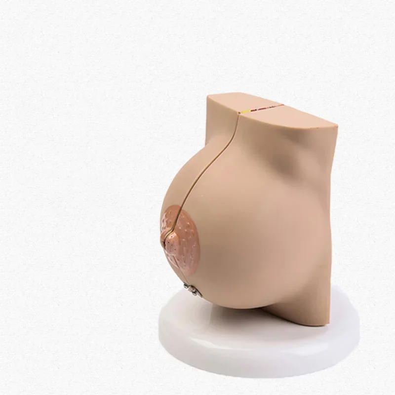 Breast Lesion Model Human Female Quiescent Breast Anatomy Model Environmentally Friendly Medical Teaching Display Model