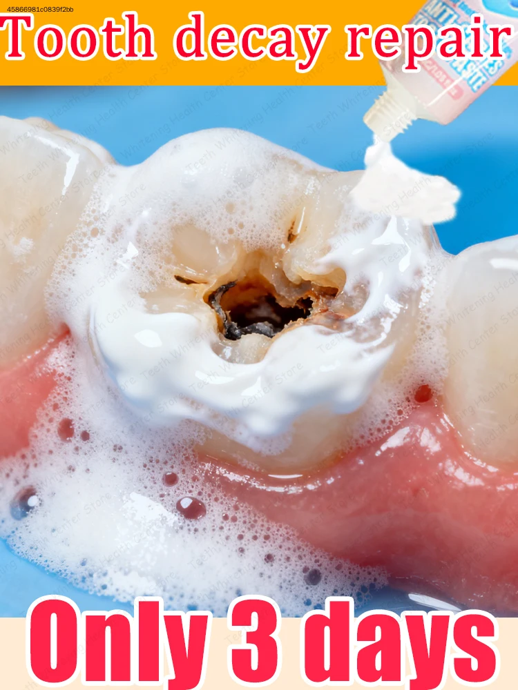 

Effective oral cleaning and ᴛᴏᴏᴛʜ ʀᴇᴘᴀɪʀ ɪɴ 3 ᴅᴀʏs