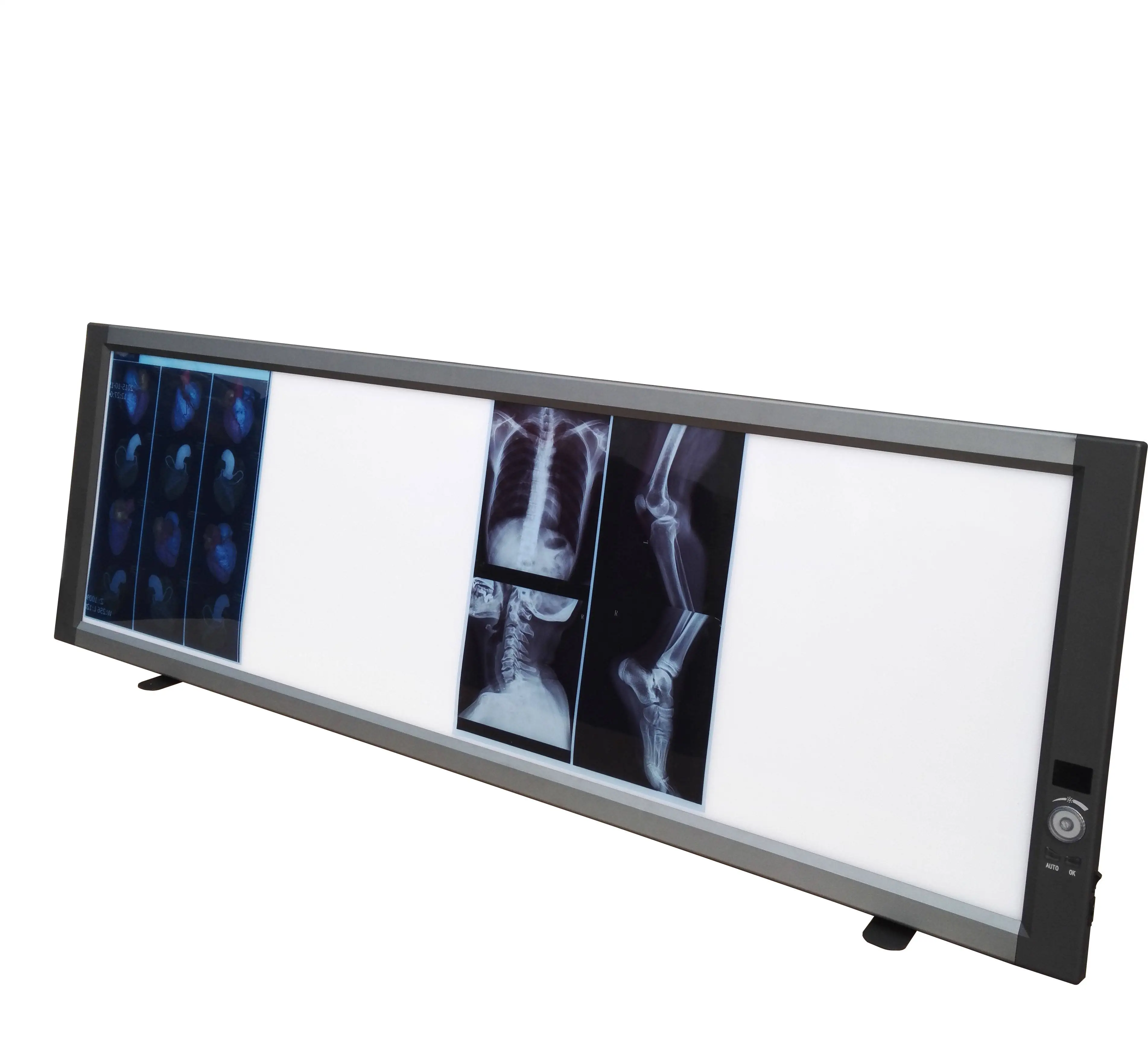 

ZG-4C Medical denta X-Ray Film Viewer Portable X Ray Film Viewing Box Negatoscope 4 China Led Negatoscope Dentaire