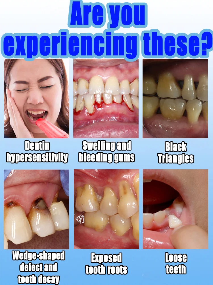 Effective tre-atm-ent of gum da-ma-ge,Rapid gum gr-ow-th,re-lie-ve to-otha-che, Pro-te-ct gums,Red-uce the ga-p between teeth