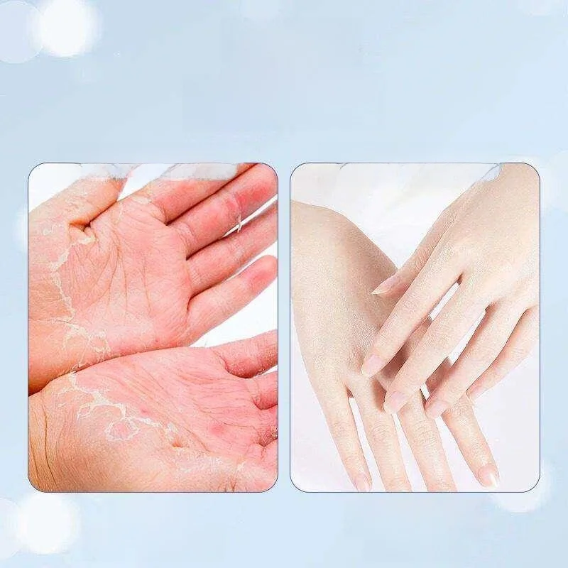 Pure Cotton Thin Gloves for Hand Care Medicine Application Moisturizing Non-Slip Cut-Resistant Sleeping Hand Mask Prevent Dry...