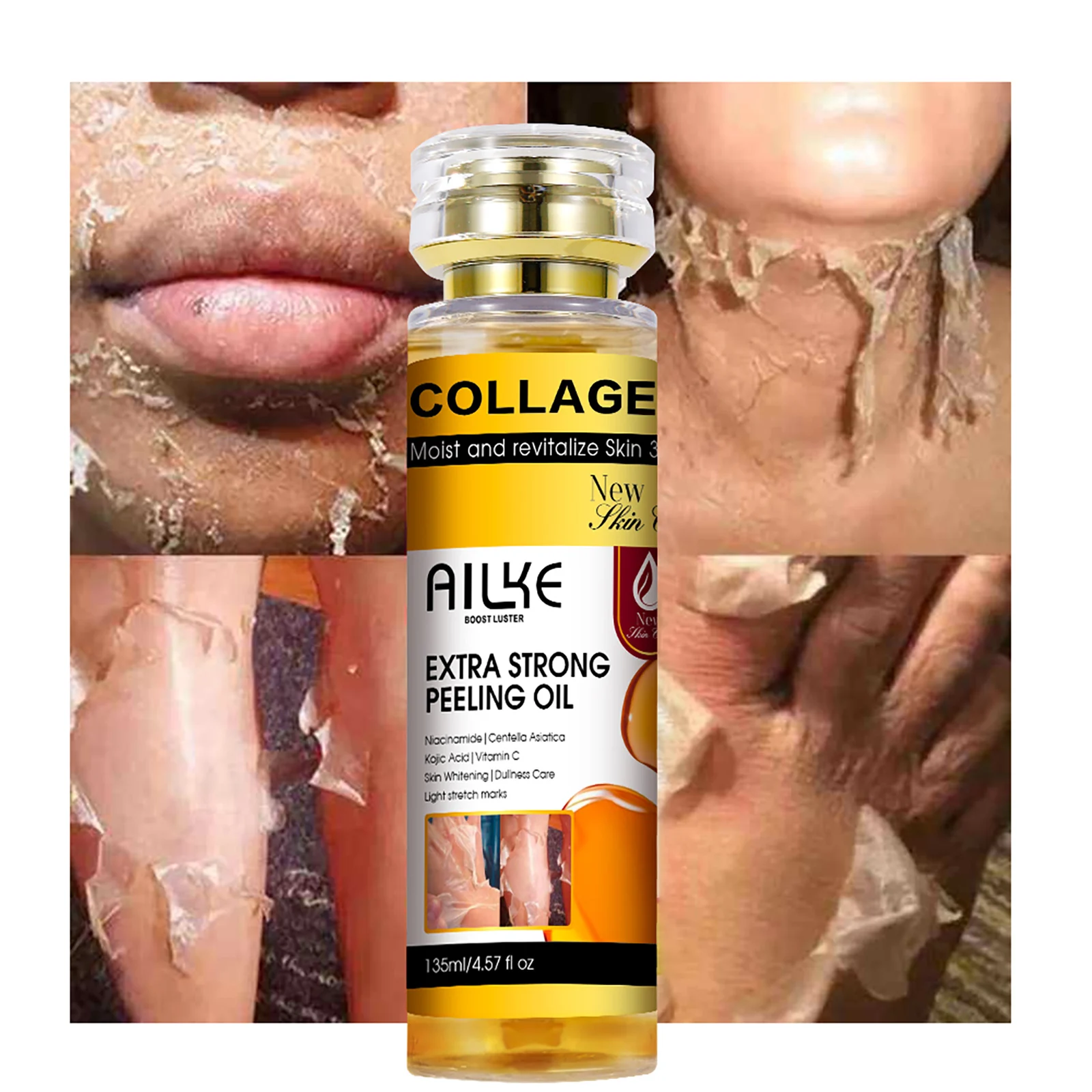 AILKE Collagen Yellow Peeling Oil For All Skin Types, Stretch Mark Removal, Lightening , Improve Rough Skin, Gentle Exfoliation