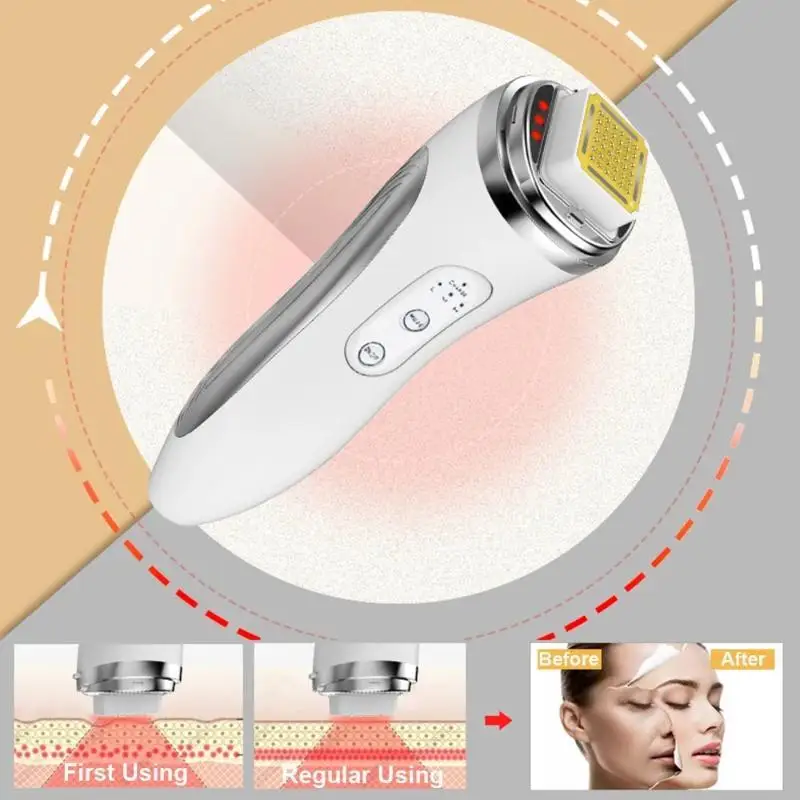 New RF Radio Frequency Face Lifting Device | Dot Matrix Skin Tightening Machine For Home Use Anti-Wrinkle Facial Massager