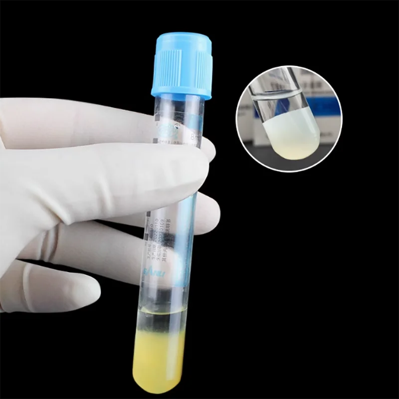 Sterile Vacuum Blood Collection Tube 8ml Vacuum Container With Sodium Citrate & Seperate Gel Blood Collectio Tube KIT