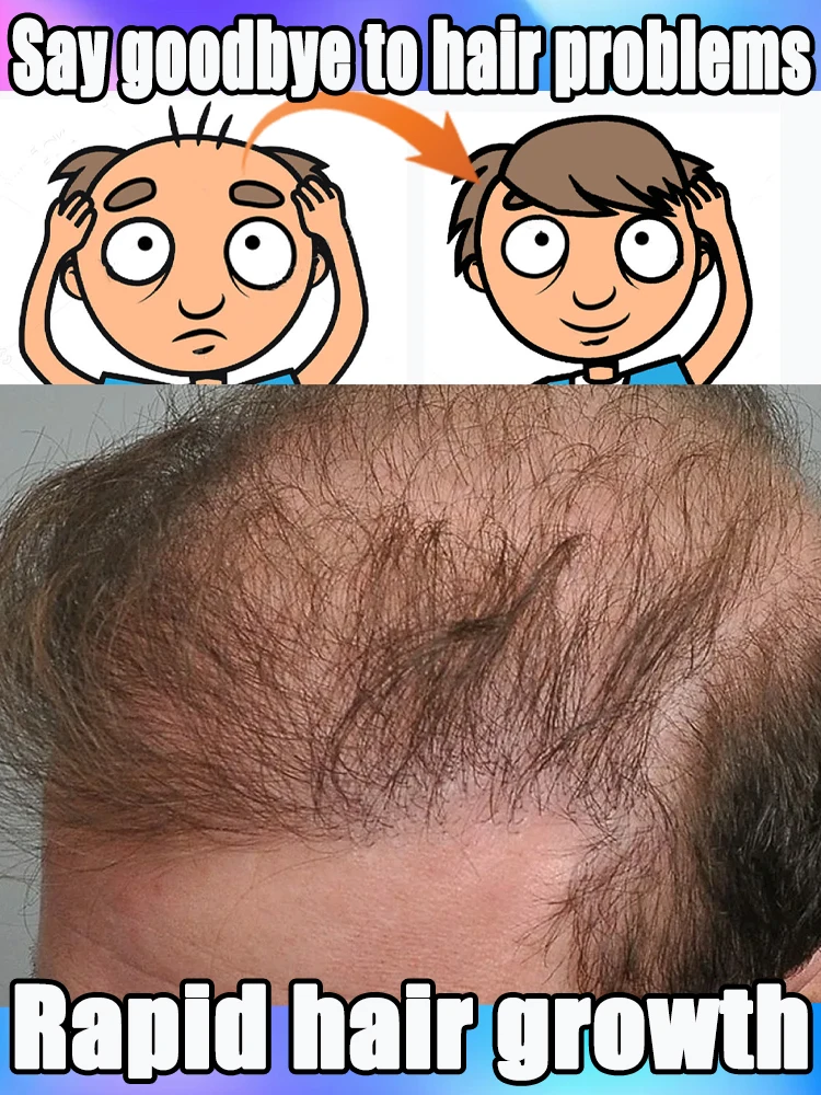 太い髪、売れ筋商品