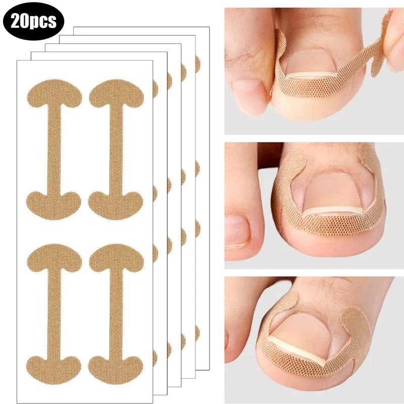 5-35sheet Adhesive Toenail Patch Ingrown Toe Nail Correction Sticker Foot Corrector Pedicure Health Care Tools Toe Treatment Pad