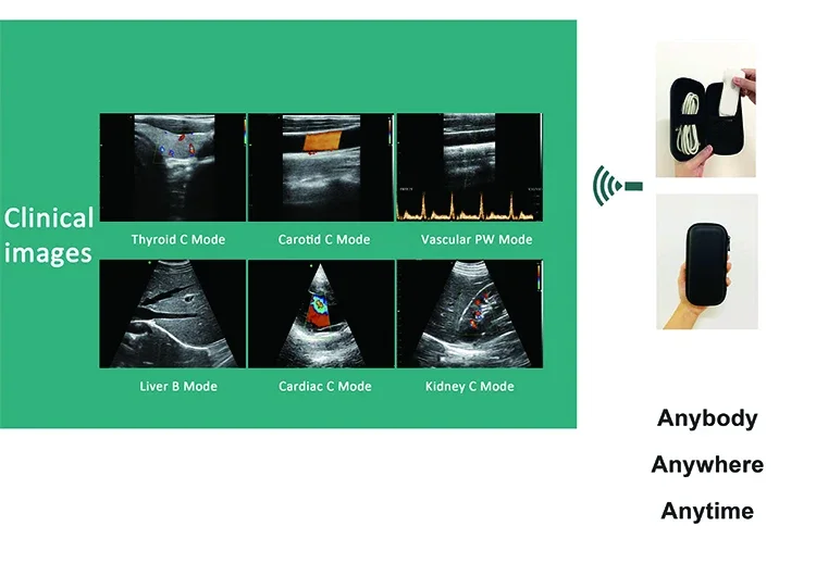 MY-A023H-N przenośny skaner ultradźwiękowy doppler mikro wypukły usb wifi bezprzewodowa sonda ultradźwiękowe 3 w 1 do laptopa z systemem Android