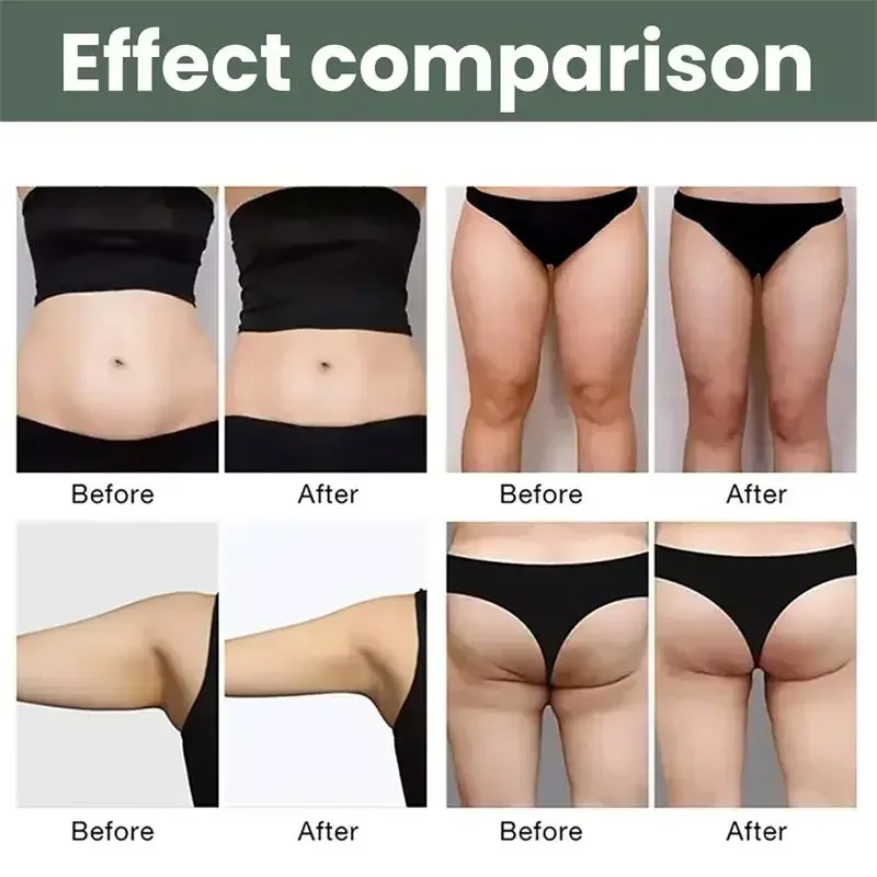 Fast Effective Body Slimming Cream Fat Burn Weight Loss Remove Belly Thigh Body Fat Keep Body Firming Belly Lose Cream Hot