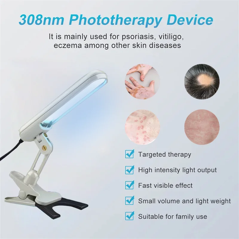 

308nm UVB Treatment Instrument Narrow Band Ultraviolet Phototherapy LampVitiligo Psoriasis Skin Treatment Device Light