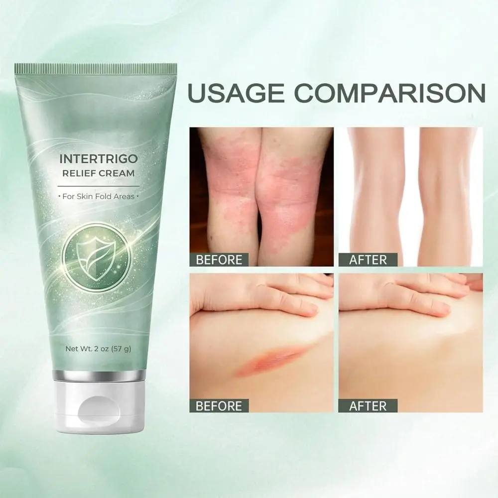For Eliminate Discomfort Intertrigo Relief Cream Reduces Friction Quick-drying Body Cream Keeps Creases Dry All Day Body Care